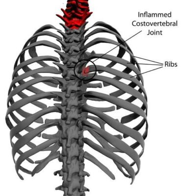 rib-pain