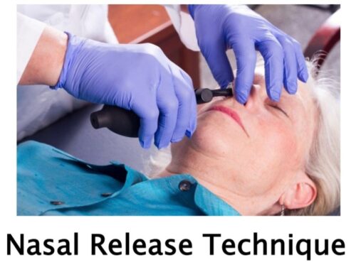 What is Nasal Release Technique?