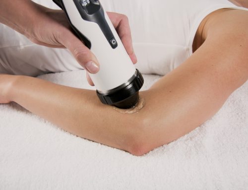 Shockwave Therapy for Tennis Elbow: Why Cortisone Works Fast But Shockwave Wins Long-Term