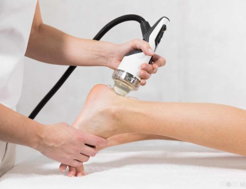 Shockwave Therapy for Achilles Tendinopathy: Why Chronic Tendon Pain Stops Healing — and What Actually Fixes It